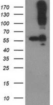 Western Blot: CDCP1 Antibody (2C1) [NBP2-03459] - HEK293T cells were transfected with the pCMV6-ENTRY control (Left lane) or pCMV6-ENTRY CDCP1 (Right lane) cDNA for 48 hrs and lysed. Equivalent amounts of cell lysates (5 ug per lane) were separated by SDS-PAGE and immunoblotted with anti-CDCP1.