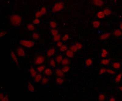 Immunocytochemistry/Immunofluorescence: CDCP1 Antibody (B2-E6) [NBP2-75929] - staining CDCP1 (red) in A549 cells. Cells were fixed in paraformaldehyde, permeabilised with 0.25% Triton X100/PBS.