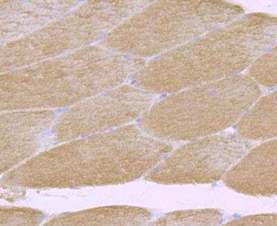 Immunohistochemistry-Paraffin: CDCP1 Antibody (B2-E6) [NBP2-75929] - Analysis of rat skeletal muscle tissue using anti-CDCP1 antibody. Counter stained with hematoxylin.