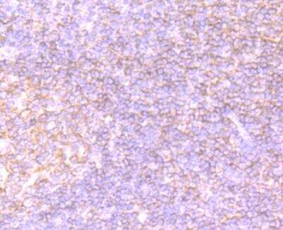 Immunohistochemistry-Paraffin: CDCP1 Antibody (B2-E6) [NBP2-75929] - Analysis of human tonsil tissue using anti-CDCP1 antibody. Counter stained with hematoxylin.