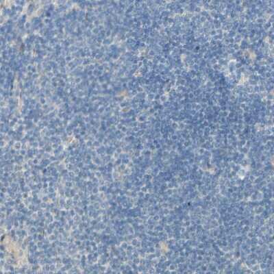 Immunohistochemistry-Paraffin: CDCP1 Antibody [NBP1-85758] - Staining of human lymph node shows no positivity in non-germinal center cells as expected.