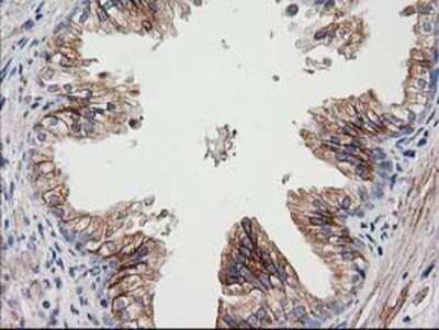 Immunohistochemistry: CDCP1 Antibody (OTI2C1) - Azide and BSA Free [NBP2-72156] - Staining of paraffin-embedded Human prostate tissue using anti-CDCP1 mouse monoclonal antibody.