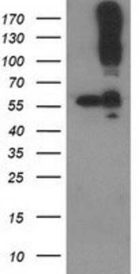Western Blot: CDCP1 Antibody (OTI2C1) - Azide and BSA Free [NBP2-72156] - HEK293T cells were transfected with the pCMV6-ENTRY control (Left lane) or pCMV6-ENTRY CDCP1 (Right lane) cDNA for 48 hrs and lysed. Equivalent amounts of cell lysates (5 ug per lane) were separated by SDS-PAGE and immunoblotted with anti-CDCP1.