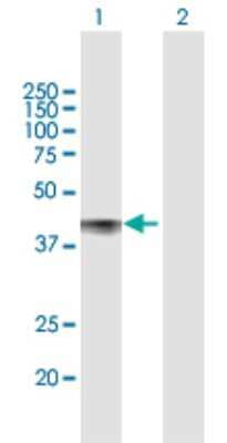 Western Blot: CDCP1 Antibody [H00064866-B01P] - Analysis of CDCP1 expression in transfected 293T cell line by CDCP1 polyclonal antibody.  Lane 1: CDCP1 transfected lysate(37.73 KDa). Lane 2: Non-transfected lysate.