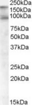 Western Blot: CDCP1 Antibody [NB100-860] - (1ug/ml) staining of Human Colon lysate (35ug protein in RIPA buffer).