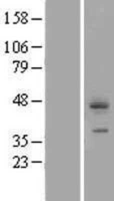Western Blot: CDCP1 Overexpression Lysate (Adult Normal) [NBP2-04991] Left-Empty vector transfected control cell lysate (HEK293 cell lysate); Right -Over-expression Lysate for CDCP1.