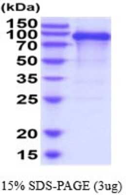 SDS-Page: Recombinant Human CDCP1 Protein [NBP2-52306] - 15% SDS Page (3 ug)