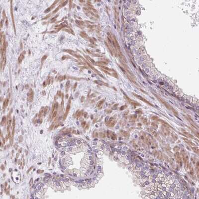 Immunohistochemistry-Paraffin: CDGSH Iron Sulfur Domain 3 Antibody [NBP2-30633] - Staining of human prostate shows moderate cytoplasmic positivity in smooth muscle cells.