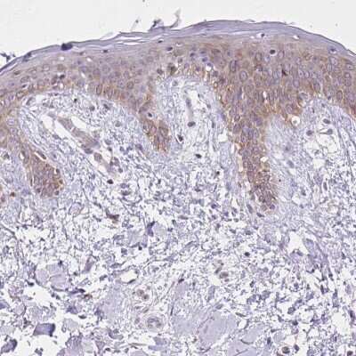 Immunohistochemistry-Paraffin: CDGSH Iron Sulfur Domain 3 Antibody [NBP2-30633] - Staining of human skin shows weak cytoplasmic positivity in squamous epithelial cells.