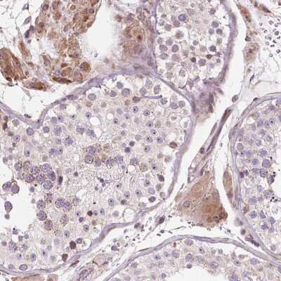 Immunohistochemistry-Paraffin: CDGSH Iron Sulfur Domain 3 Antibody [NBP2-30633] - Staining of human testis shows moderate cytoplasmic positivity in Leydig cells.