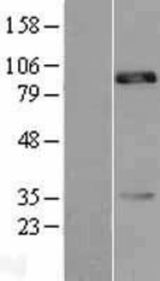 Western Blot: CDH18 Overexpression Lysate (Adult Normal) [NBL1-09029] Left-Empty vector transfected control cell lysate (HEK293 cell lysate); Right -Over-expression Lysate for CDH18.