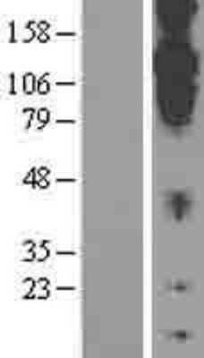 Western Blot: CDH20 Overexpression Lysate (Adult Normal) [NBL1-09031] Left-Empty vector transfected control cell lysate (HEK293 cell lysate); Right -Over-expression Lysate for CDH20.