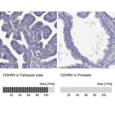 Immunohistochemistry-Paraffin: CDHR4 Antibody [NBP2-62703] - Analysis in human fallopian tube and prostate tissues using Anti-CDHR4 antibody. Corresponding CDHR4 RNA-seq data are presented for the same tissues.