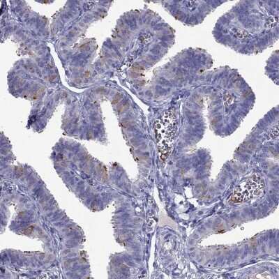 Immunohistochemistry-Paraffin: CDHR4 Antibody [NBP2-62703] - Staining of human fallopian tube shows high expression.