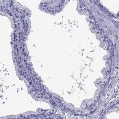 Immunohistochemistry-Paraffin: CDHR4 Antibody [NBP2-62703] - Staining of human prostate shows low expression as expected.