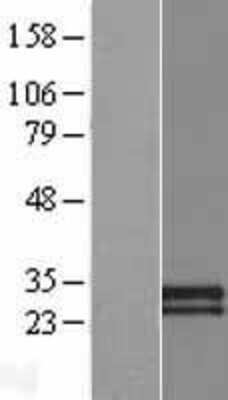 Western Blot: CDHR4 Overexpression Lysate (Adult Normal) [NBP2-08818] Left-Empty vector transfected control cell lysate (HEK293 cell lysate); Right -Over-expression Lysate for CDHR4.