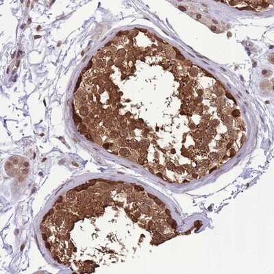 Immunohistochemistry-Paraffin: CDIP Antibody [NBP2-14381] - Staining of human testis shows strong cytoplasmic and nuclear positivity in cells of seminiferus ducts.