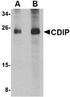 Western Blot: CDIP Antibody [NBP1-76993] - Human brain lysate with CDIP antibody at (A) 1 and (B) 2 ug/ml.
