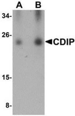 Western Blot: CDIP Antibody [NBP1-76996] - Human brain lysate with CDIP antibody at (A) 0.25 and (B) 0.5 ug/ml.