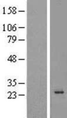 Western Blot: CDIP Overexpression Lysate (Adult Normal) [NBL1-08215] Left-Empty vector transfected control cell lysate (HEK293 cell lysate); Right -Over-expression Lysate for CDIP.