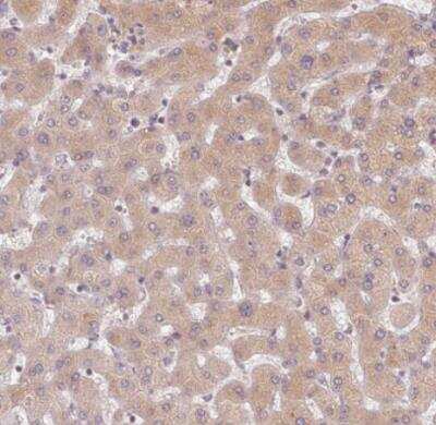 Immunohistochemistry-Paraffin: CDIPT Antibody [NBP2-49233] - Staining of human liver shows weak cytoplasmic positivity in hepatocytes.
