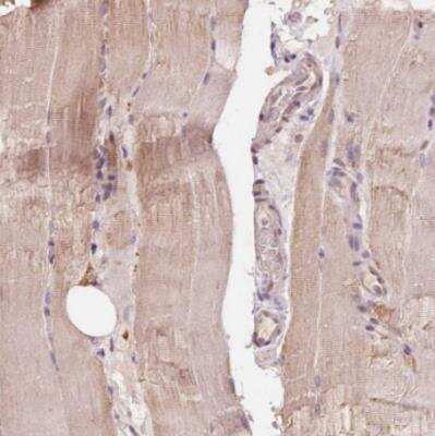 Immunohistochemistry-Paraffin: CDIPT Antibody [NBP2-49233] - Staining of human skeletal muscle shows weak cytoplasmic positivity in myocytes.