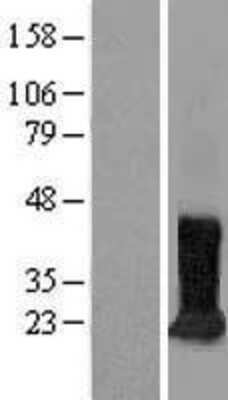 Western Blot: CDIPT Overexpression Lysate (Adult Normal) [NBL1-09036] Left-Empty vector transfected control cell lysate (HEK293 cell lysate); Right -Over-expression Lysate for CDIPT.