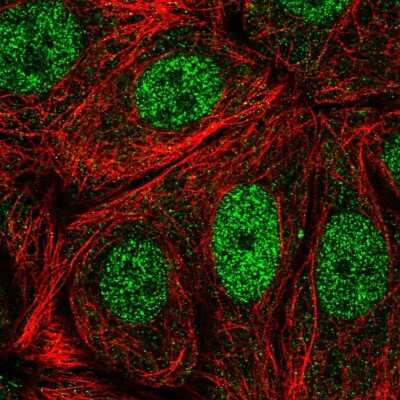 Immunocytochemistry/Immunofluorescence: CDK10 Antibody [NBP2-55913] - Staining of human cell line MCF7 shows localization to nucleoplasm.