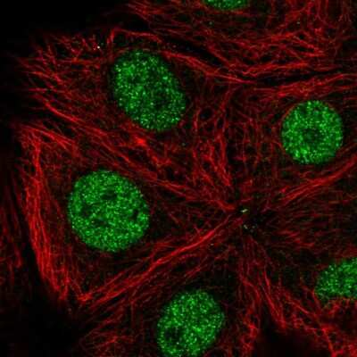 Immunocytochemistry/Immunofluorescence: CDK10 Antibody [NBP2-57779] - Staining of human cell line MCF7 shows localization to nucleoplasm.