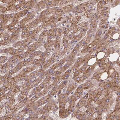 Immunohistochemistry: CDK10 Antibody [NBP2-68579] - Immunohistochemical staining of human liver shows strong positivity with a granular pattern in hepatocytes.