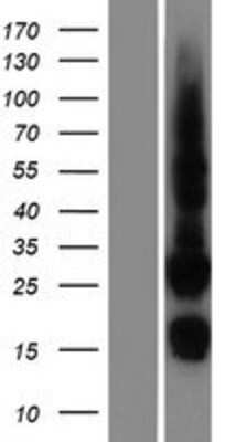 Western Blot CDK10 Overexpression Lysate