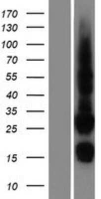 Western Blot: CDK10 Overexpression Lysate (Adult Normal) [NBP2-05828] Left-Empty vector transfected control cell lysate (HEK293 cell lysate); Right -Over-expression Lysate for CDK10.