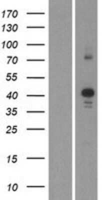 Western Blot: CDK10 Overexpression Lysate (Adult Normal) [NBP2-05829] Left-Empty vector transfected control cell lysate (HEK293 cell lysate); Right -Over-expression Lysate for CDK10.