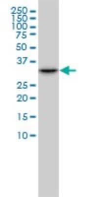 Western Blot: CDK2 Antibody (2E8) [H00001017-M02] - CDK2 monoclonal antibody (M02), clone 2E8 Analysis of CDK2 expression in HL-60.