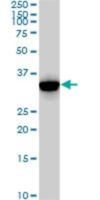 Western Blot: CDK2 Antibody (2E8) [H00001017-M02] - CDK2 monoclonal antibody (M02), clone 2E8. Analysis of CDK2 expression in Jurkat.