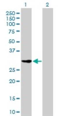 Western Blot: CDK2 Antibody (2E8) [H00001017-M02] - Analysis of CDK2 expression in transfected 293T cell line by CDK2 monoclonal antibody (M02), clone 2E8.Lane 1: CDK2 transfected lysate(33.9 KDa).Lane 2: Non-transfected lysate.
