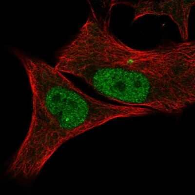 Immunocytochemistry/Immunofluorescence: CDK2 Antibody [NBP2-57327] - Staining of human cell line SK-MEL-30 shows localization to nucleoplasm & centrosome.