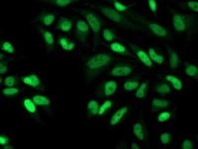 Immunocytochemistry/Immunofluorescence: CDK2 Antibody (OTI2D9) - Azide and BSA Free [NBP2-70392] - Staining of HeLa cells using anti-Cdk2 mouse monoclonal antibody.