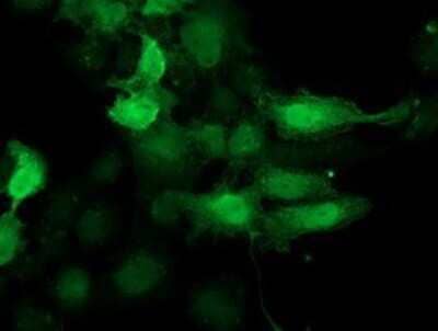 Immunocytochemistry/Immunofluorescence: CDK2 Antibody (OTI2D9) - Azide and BSA Free [NBP2-70392] - Staining of COS7 cells transiently transfected by pCMV6-ENTRY Cdk2.