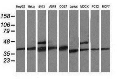 Western Blot: CDK2 Antibody (OTI2D9) - Azide and BSA Free [NBP2-70392] - Analysis of extracts (35ug) from 9 different cell lines by using anti-Cdk2 monoclonal antibody.