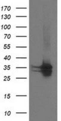 Western Blot: CDK2 Antibody (OTI2D9) - Azide and BSA Free [NBP2-70392] - HEK293T cells were transfected with the pCMV6-ENTRY control (Left lane) or pCMV6-ENTRY Cdk2 (Right lane) cDNA for 48 hrs and lysed. Equivalent amounts of cell lysates (5 ug per lane) were separated by SDS-PAGE and immunoblotted with anti-Cdk2.