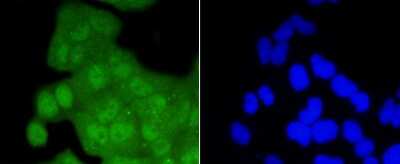 Immunocytochemistry/Immunofluorescence: CDK2 Antibody (SR01-01) [NBP2-67348] - Staining Cdk2 in Hela cells (green). The nuclear counter stain is DAPI (blue). Cells were fixed in paraformaldehyde, permeabilised with 0.25% Triton X100/PBS.