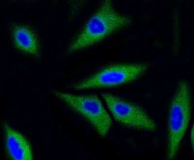 Immunocytochemistry/Immunofluorescence: CDK2 Antibody (SR01-01) [NBP2-67348] - Staining Cdk2 in SH-SY-5Y cells (green). Cells were fixed in paraformaldehyde, permeabilised with 0.25% Triton X100/PBS.