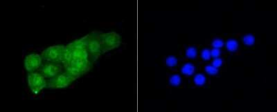Immunocytochemistry/Immunofluorescence: CDK2 Antibody (SR01-01) [NBP2-67348] - Staining Cdk2 in CRC cells (green). The nuclear counter stain is DAPI (blue). Cells were fixed in paraformaldehyde, permeabilised with 0.25% Triton X100/PBS.