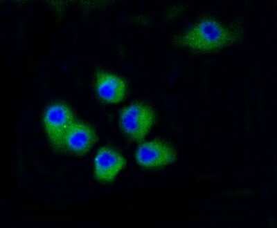 Immunocytochemistry/Immunofluorescence: CDK2 Antibody (SR01-01) [NBP2-67348] - Staining Cdk2 in N2A cells (green). Cells were fixed in paraformaldehyde, permeabilised with 0.25% Triton X100/PBS.