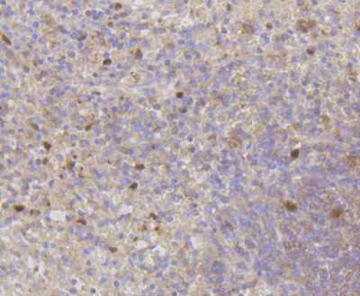 Immunohistochemistry-Paraffin: CDK2 Antibody (SR01-01) [NBP2-67348] - Analysis of paraffin-embedded human spleen tissue using anti-Cdk2 antibody. Counter stained with hematoxylin.