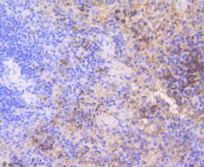 Immunohistochemistry-Paraffin: CDK2 Antibody (SR01-01) [NBP2-67348] - Analysis of paraffin-embedded mouse spleen tissue using anti-Cdk2 antibody. Counter stained with hematoxylin.