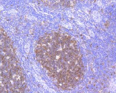 Immunohistochemistry-Paraffin: CDK2 Antibody (SR01-01) [NBP2-67348] - Immunohistochemical analysis of paraffin-embedded human tonsil tissue using anti-CDK2 antibody. The section was pre-treated using heat mediated antigen retrieval with Tris-EDTA buffer (pH 8.0-8.4) for 20 minutes. The tissues were blocked in 5% BSA for 30 minutes at room temperature, washed with ddH2O and PBS, and then probed with the primary antibody (ET1602-6, 1/200) for 30 minutes at room temperature. The detection was performed using an HRP conjugated compact polymer system. DAB was used as the chromogen. Tissues were counterstained with hematoxylin and mounted with DPX.