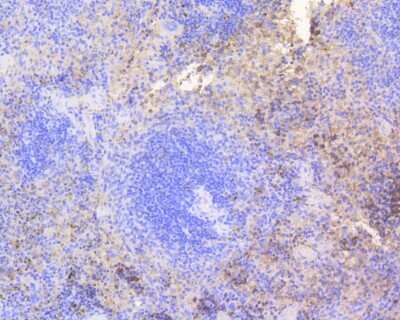 Immunohistochemistry-Paraffin: CDK2 Antibody (SR01-01) [NBP2-67348] - Immunohistochemical analysis of paraffin-embedded mouse spleen tissue using anti-CDK2 antibody. The section was pre-treated using heat mediated antigen retrieval with Tris-EDTA buffer (pH 8.0-8.4) for 20 minutes. The tissues were blocked in 5% BSA for 30 minutes at room temperature, washed with ddH2O and PBS, and then probed with the primary antibody (ET1602-6, 1/50) for 30 minutes at room temperature. The detection was performed using an HRP conjugated compact polymer system. DAB was used as the chromogen. Tissues were counterstained with hematoxylin and mounted with DPX.