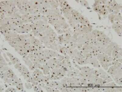 Immunohistochemistry-Paraffin: CDK20 Antibody (4D6) [H00023552-M02] - Analysis of monoclonal antibody to CCRK on formalin-fixed paraffin-embedded human heart. Antibody concentration 3 ug/ml.